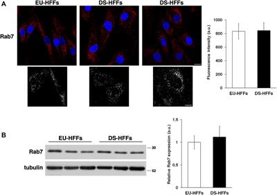 Down Syndrome Fetal Fibroblasts Display Alterations of Endosomal Trafficking Possibly due to SYNJ1 Overexpression